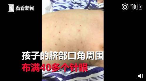 鸽子|吞蝌蚪喝蟑螂水吃鸽子粪，你被“偏方秘方”坑过吗？