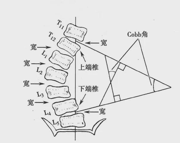 否则画面过于惊悚……每100人中,就有两三个中招!