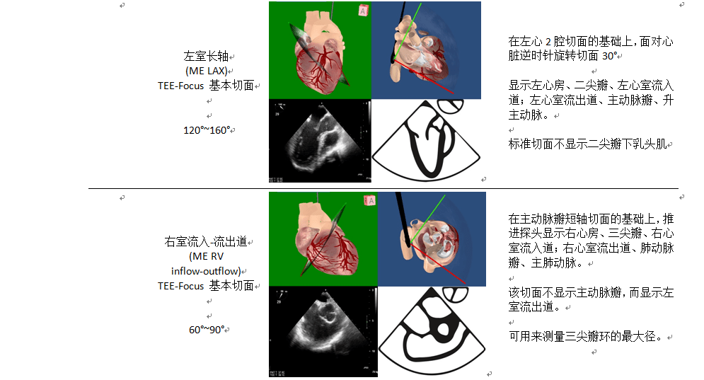 指南与共识 | 围手术期经食管超声心动图监测操作的专家共识 (一)