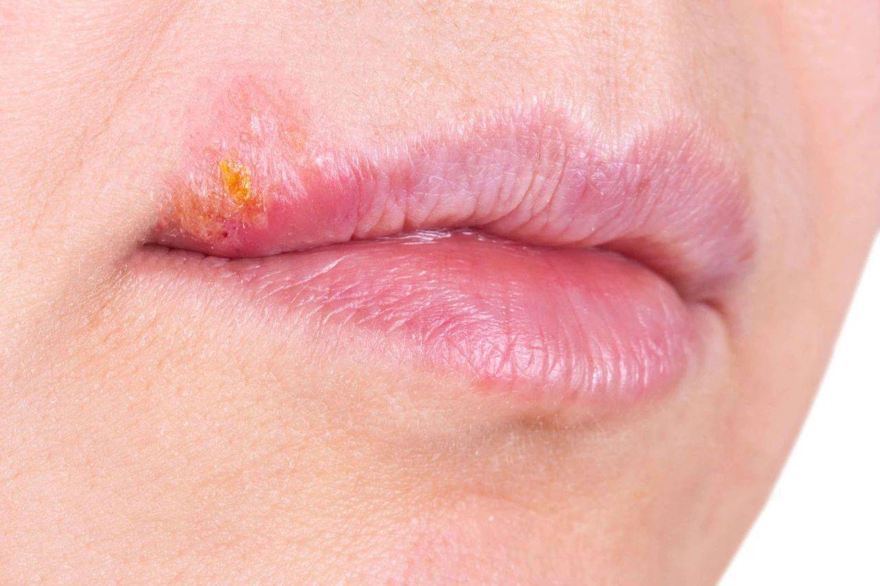 晨起时身体若有这4种异常,或是脑梗来临前的信号,早发现早就医