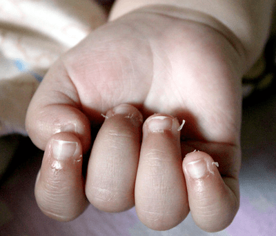 小孩咬手指甲恐怖图片图片