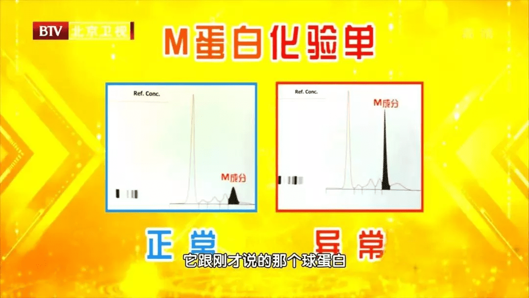 严重|长期忽视的腰痛，背后竟是致命肿瘤！潜伏期长达十年，一个鉴定，排查风险~