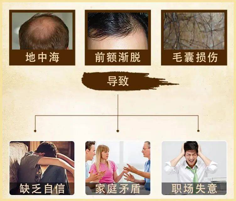 洗头|脱发、秃头，又丑又显老！这样做，头发浓密，更显年轻好气质