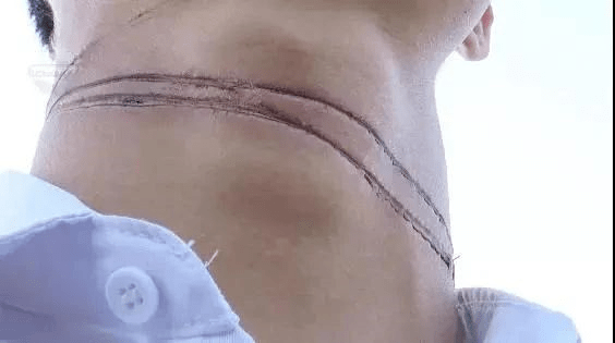 厦门海滩上女子险被割喉这种玩具千万要注意