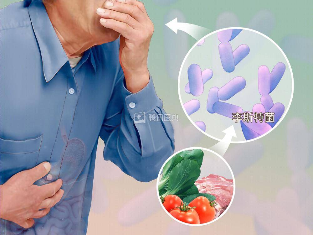 李斯特|一碗剩鸡汤，竟喝出脑膜炎？食物隔夜注意这4点