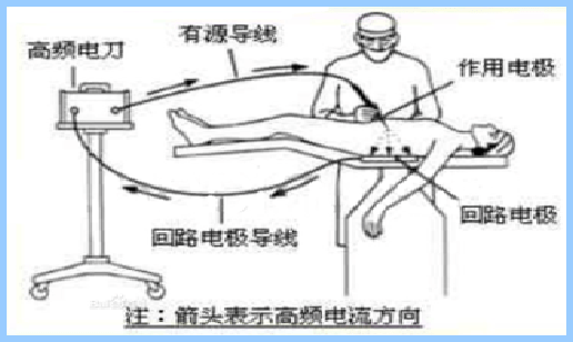 电刀负极板粘贴方向图片