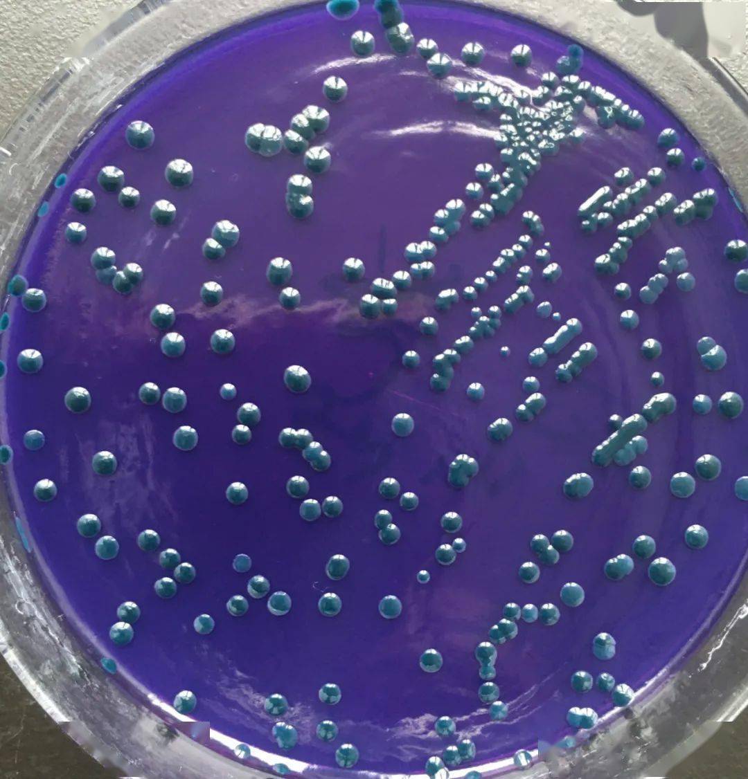 图5,绿弧菌菌落图6,枯草芽孢杆菌染色微生态制剂用于改善养殖水体环境