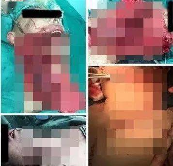 感觉|这种零食被列为1类致癌物！很多人爱吃