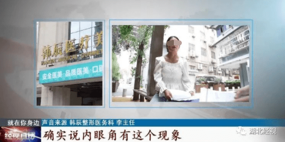 症状|说好的整成舒淇同款鼻,结果连微笑都成问题!更麻烦的是……