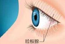 油脂|头晕、视物不清、流泪怕光，甚至失明，都是因这个很多人都有的眼病而起？