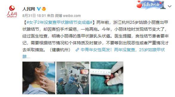 女子|女子两年没复查，甲状腺结节变成癌！只因忽视医生这句话