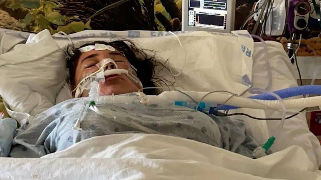 cnn截图 一名佛州青少年在感染新冠肺炎后使用呼吸机上治疗了11天,她