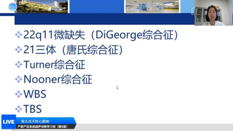 教授讲授《遗传综合征相关的胎儿心脏表型》主要讲解digeorge综合征