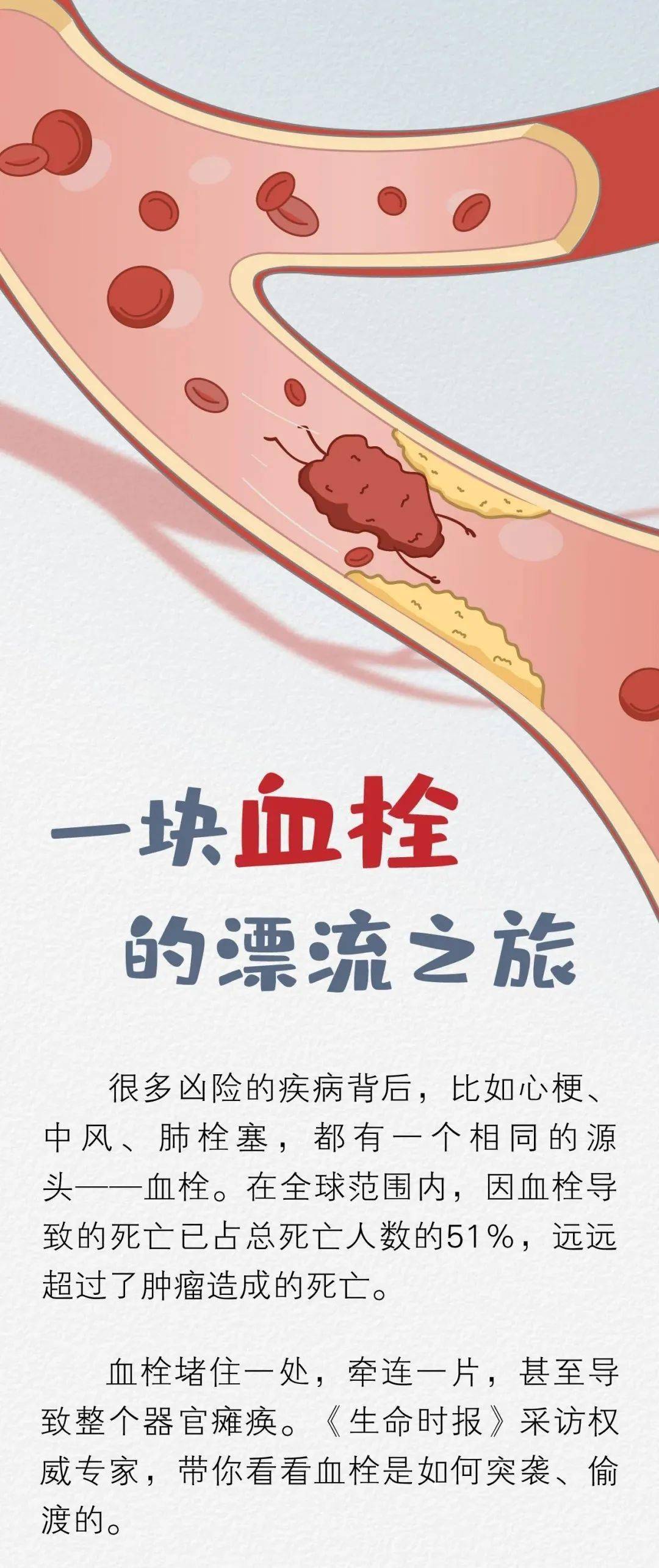 一块血栓的危险"漂流"之旅