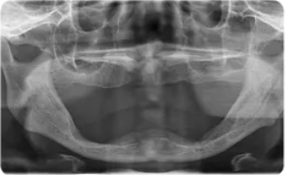 福利|种植牙大咖面对面+超强福利，机不可失，11—12日能省一大笔钱！！！