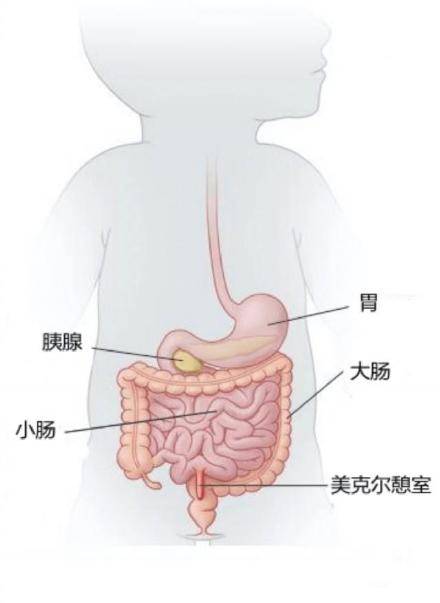 马桶|深圳12岁男孩拉了一马桶血进了PICU，罪魁祸首是肠子里多出的一块肉