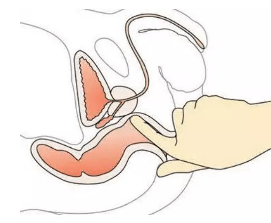 男人最重要部位之前列腺你真的了解它的作用么