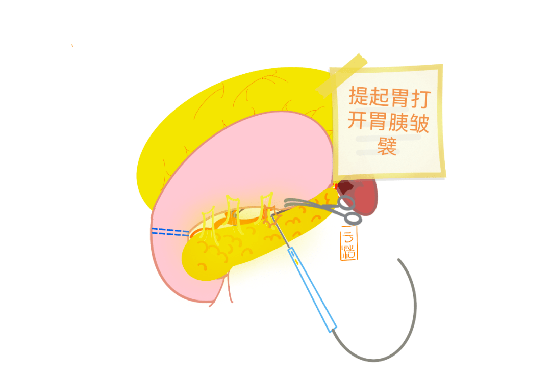 脾什么什么切成语_成语故事简笔画(2)