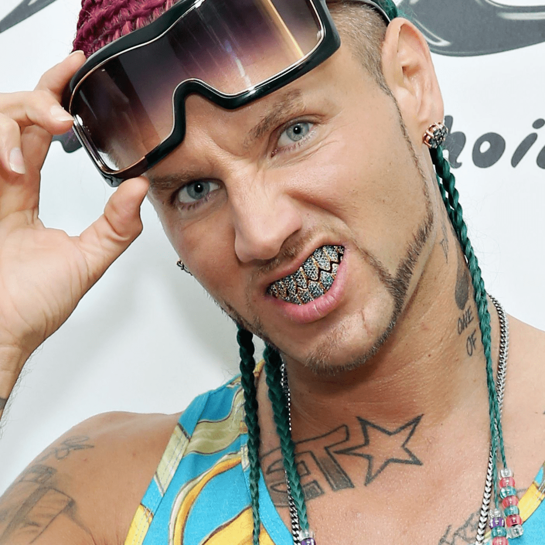 rapper钻石牙套图片