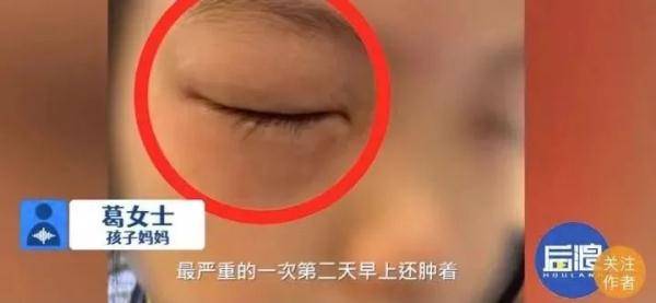 网友|小姑娘一做数学题就眼睛过敏！学校家庭和数学，谁该背锅？