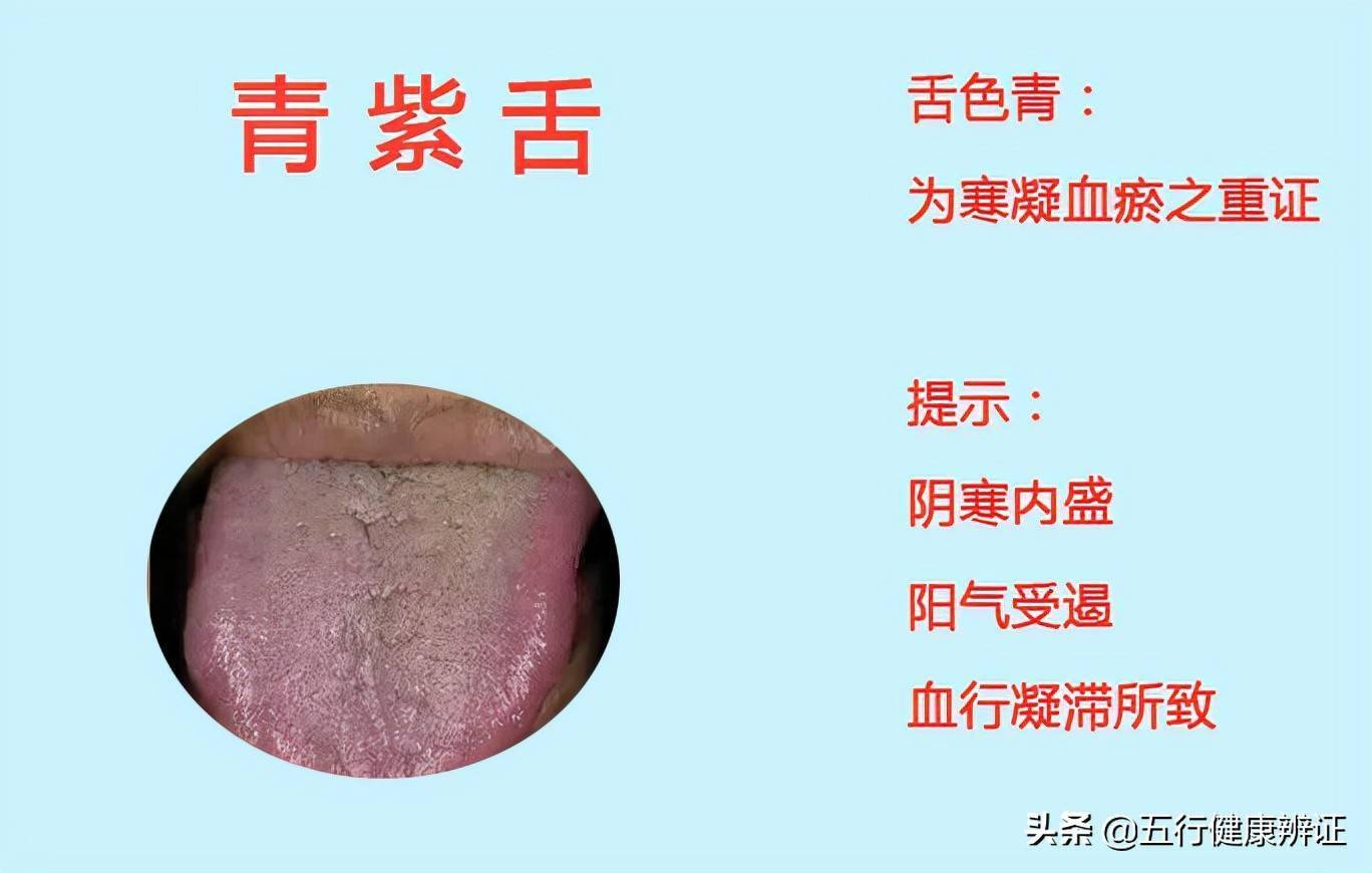 也就是说,当我们心血瘀滞时,所体现出来的就是舌头青紫.