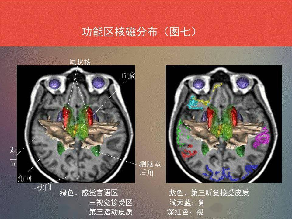 收藏| 腦功能區及解剖學定位(詳細標註)