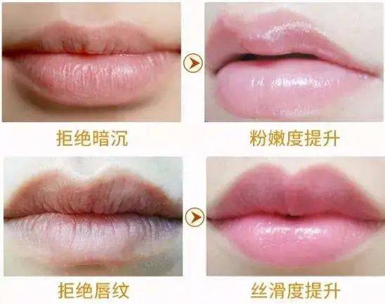 急救|唇纹又深又显老!急救起皮干裂,嘴巴像融化了一样,又软又糯贼滑溜!