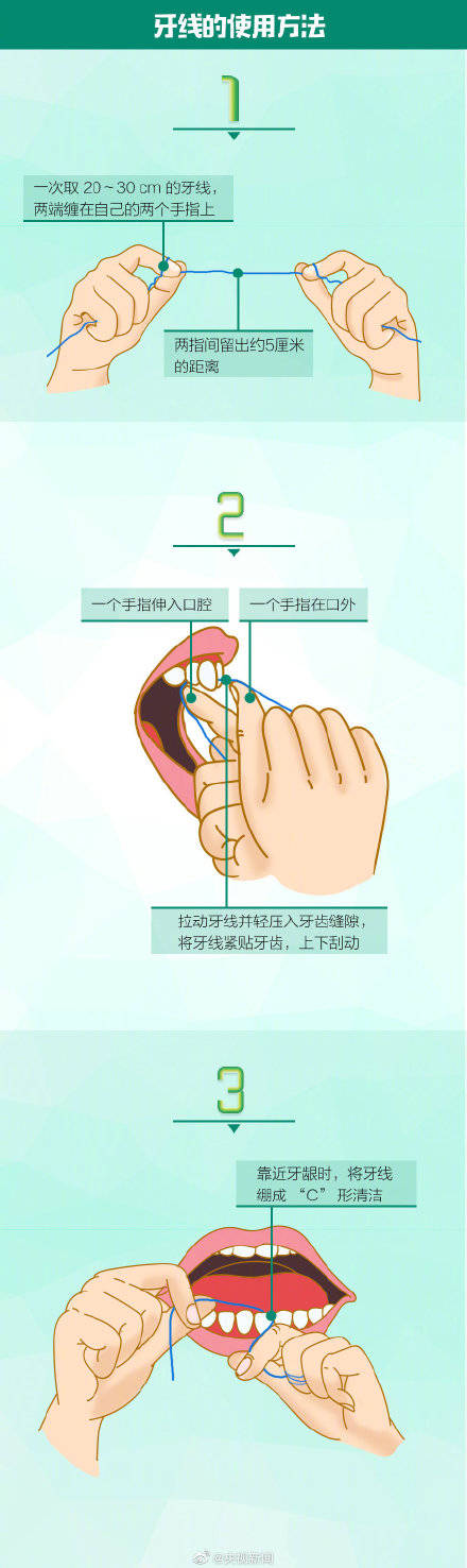 牙缝|一起了解护牙“小神器”