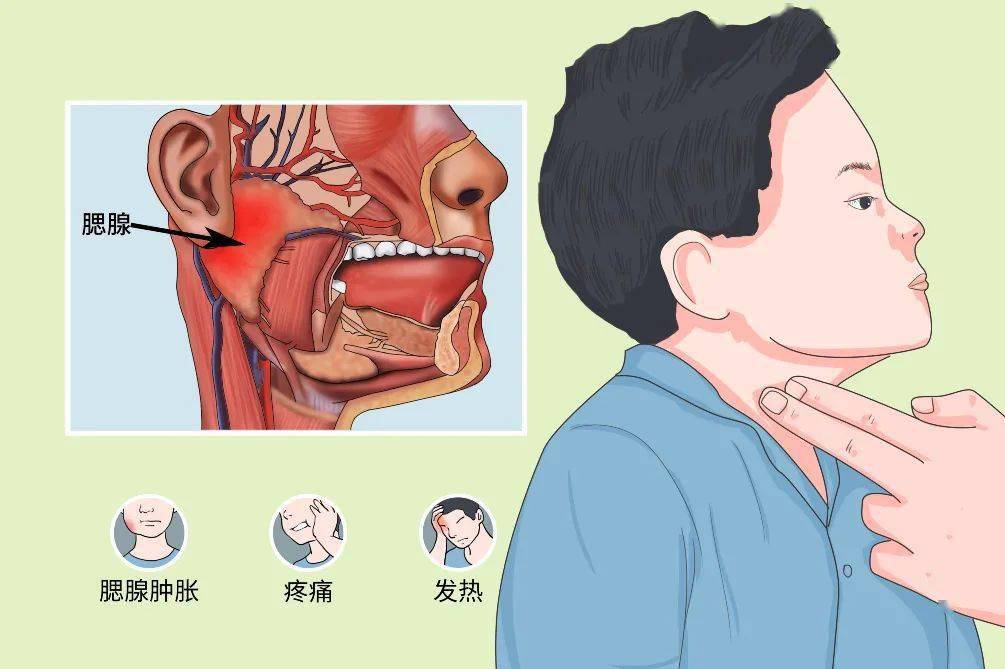 腮腺炎位置图片大全图片