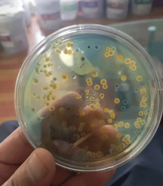 密度精养,其中对于弧菌的关注颇多,目前养殖中最常见的弧菌有溶藻弧菌
