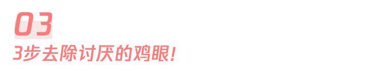 高跟鞋|“鸡眼”偏爱这4种人，你中招了吗？