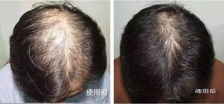 发型为了拯救发际线，日本人可是绞尽脑汁！
