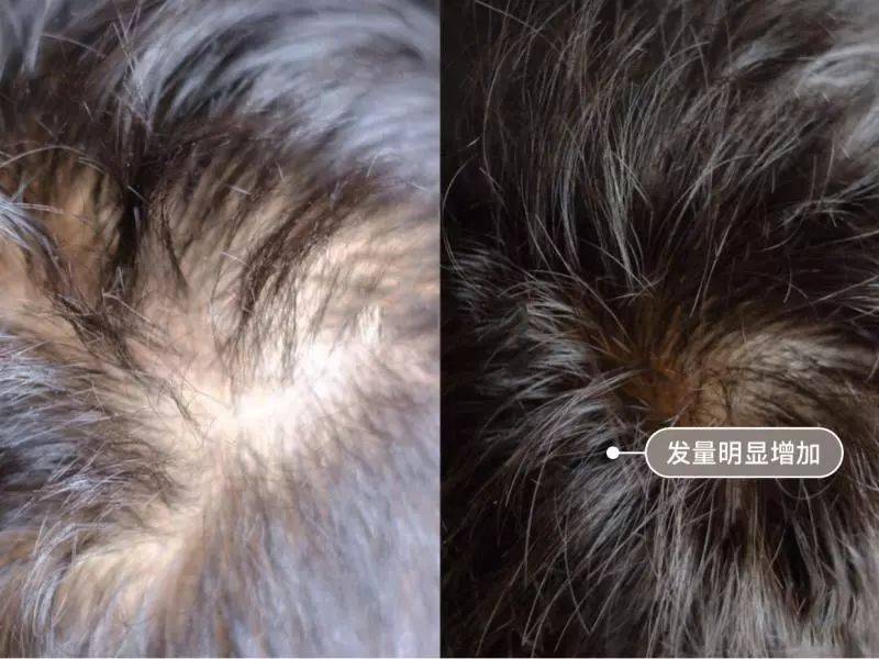 发型为了拯救发际线，日本人可是绞尽脑汁！