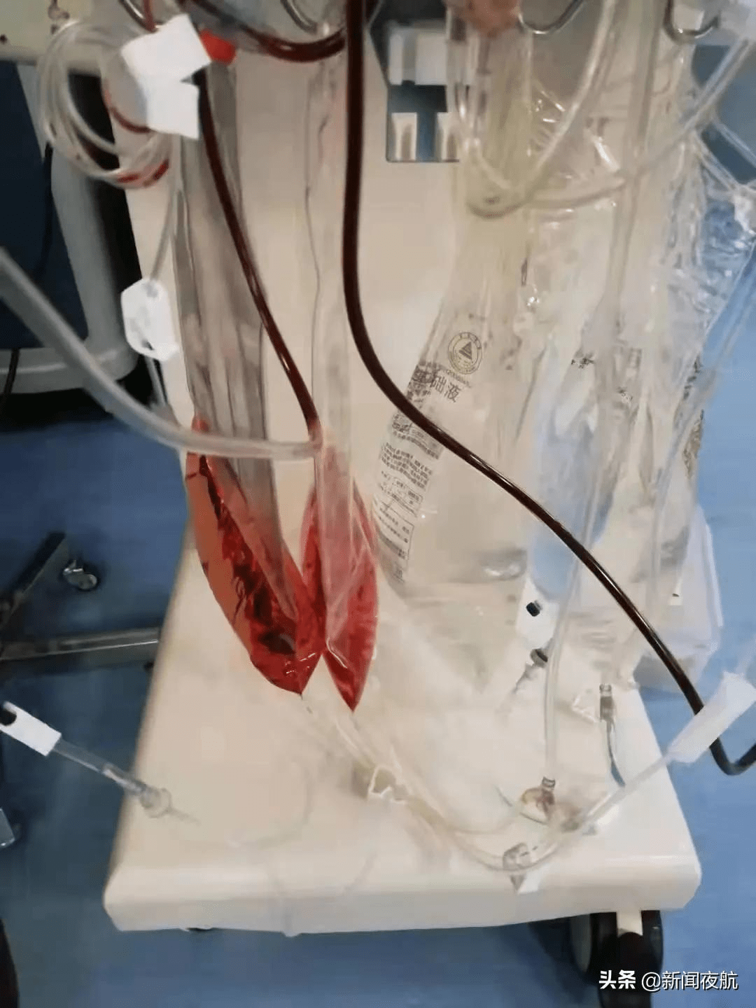 大庆|因食用野生蘑菇，大庆市4天3人中毒住进ICU