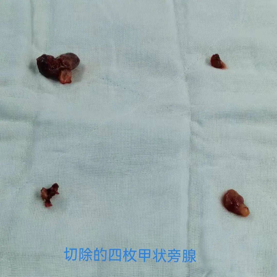 手术后刀口会痒吗 cdc0686a3c8542dd9b1fd66a9ba473c7.jpeg