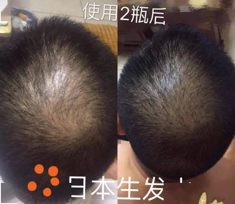 发型为了拯救发际线，日本人可是绞尽脑汁！