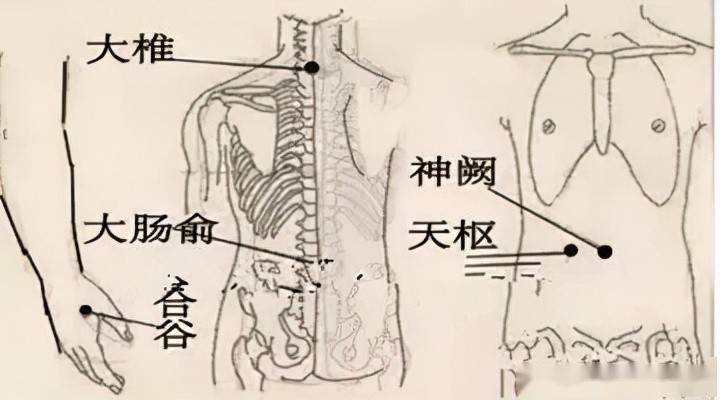 女性便秘拔罐位置图图片