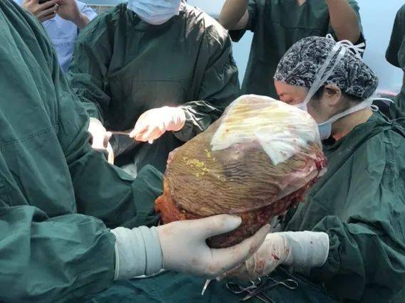 为什么乳头会有白色分泌物 为什么乳头会有白色分泌物