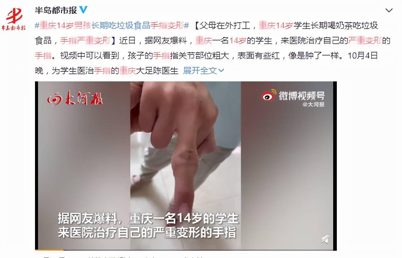 食品|别阻止孩子吃零食了，家长要做的是这件事