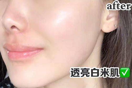 女人吃什么补胶原蛋白皮肤好 93507cf244fb494ebc22103de0acf436.jpeg