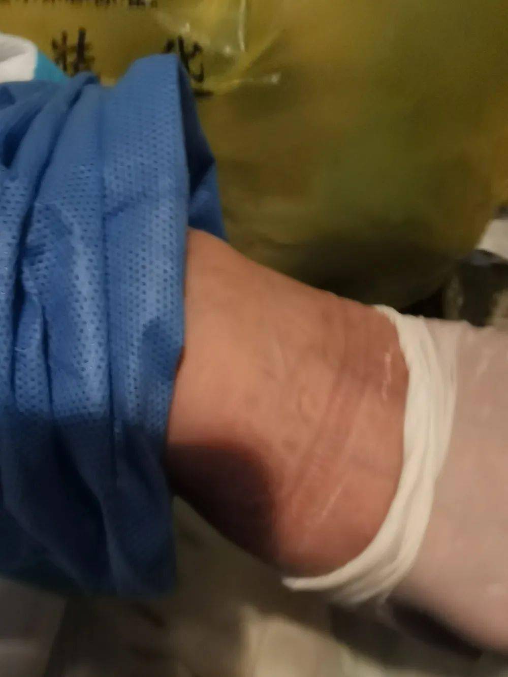 同事|“铁娘子”12小时120次入户采集，爬3000多级台阶，相当于150层楼！