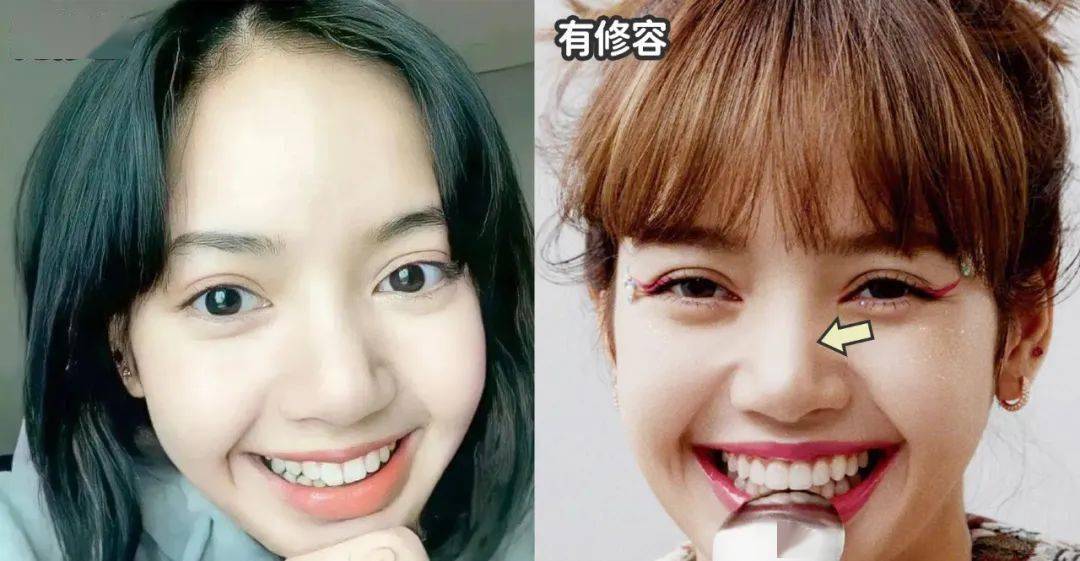 人间Lisa这是整了吗？人间芭比感怎么突然消失了？？