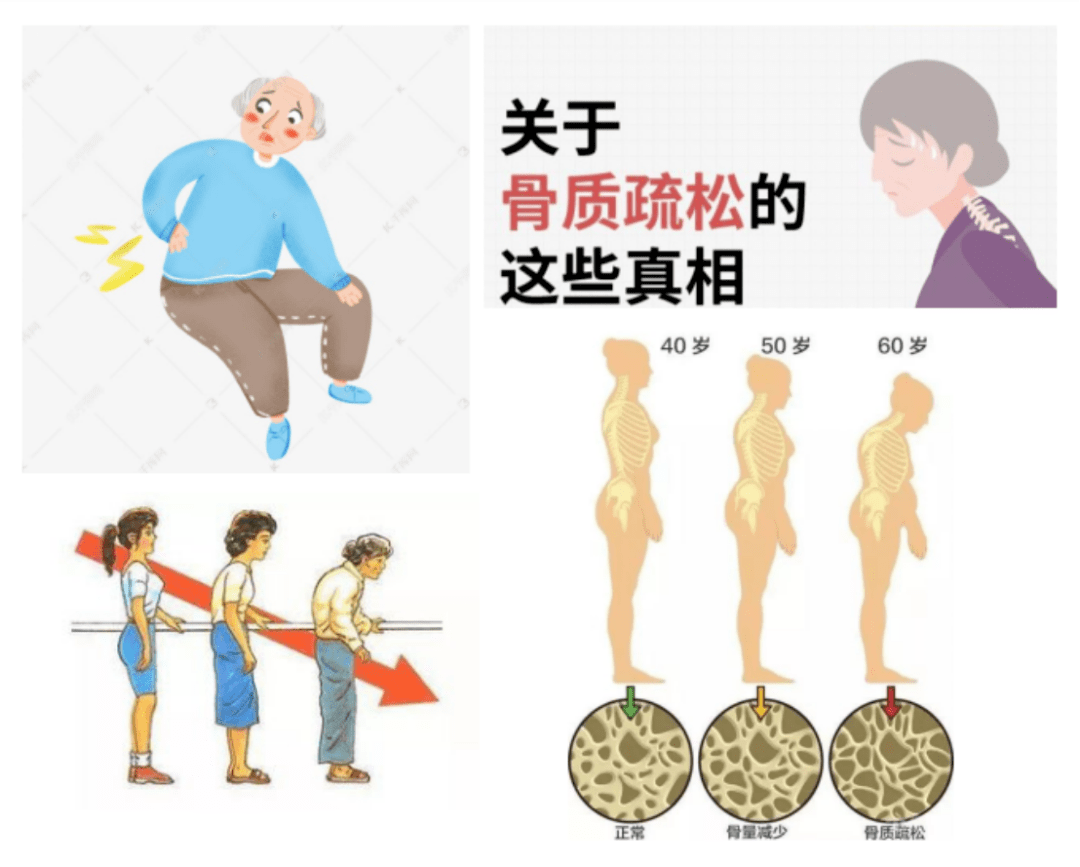 中年人骨质疏松怎么办