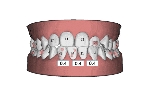 市民|@大连人！看牙消费福利券正在发放，符合条件的均可领取