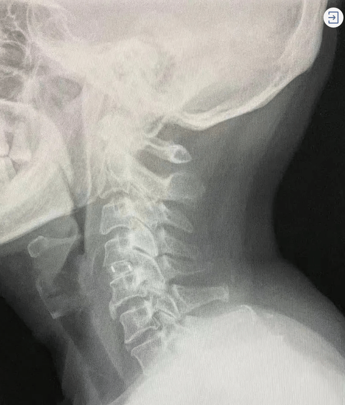 左肩|刷手机刷到医院