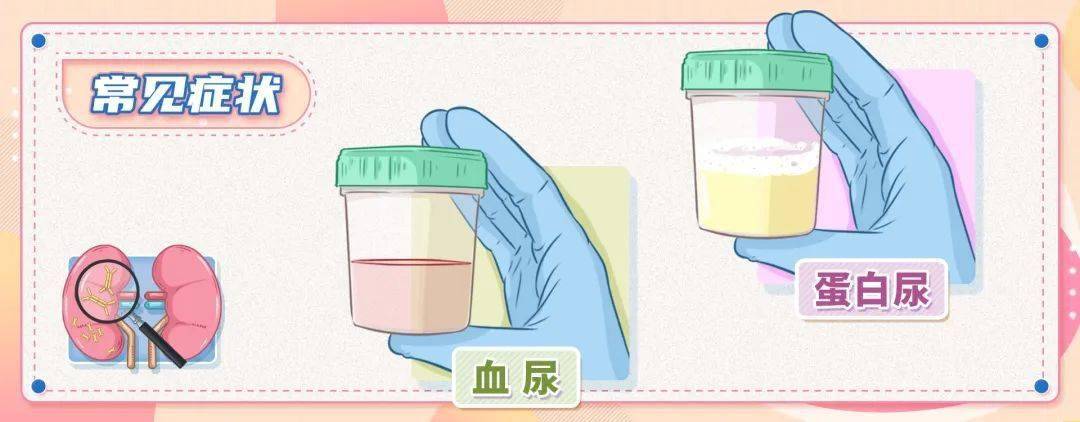 科普|院士讲科普 | IgA肾病一定会导致尿毒症吗?