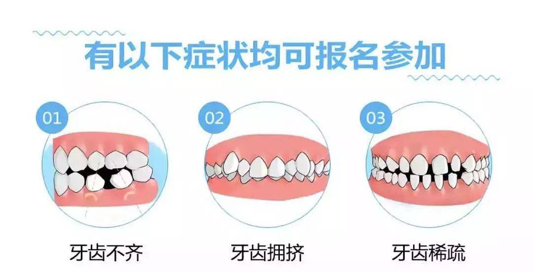 為什麼越來越多的人做牙齒矯正