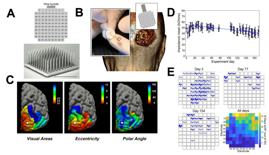 of clinical investigation上发表,题目为 visual percepts evoked