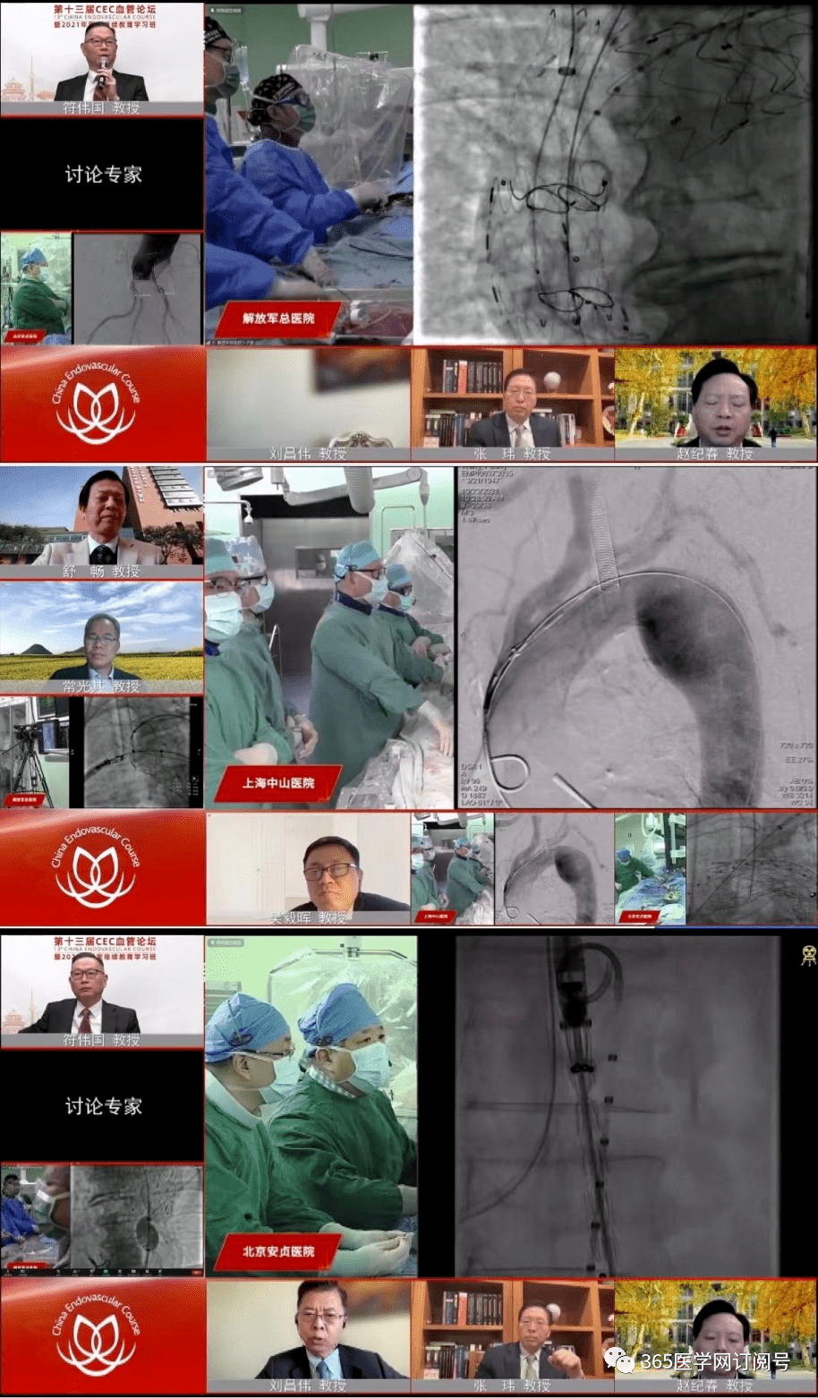 开幕式随后的主旨论坛中,中山大学附属第一医院王深明教授分享了《eva