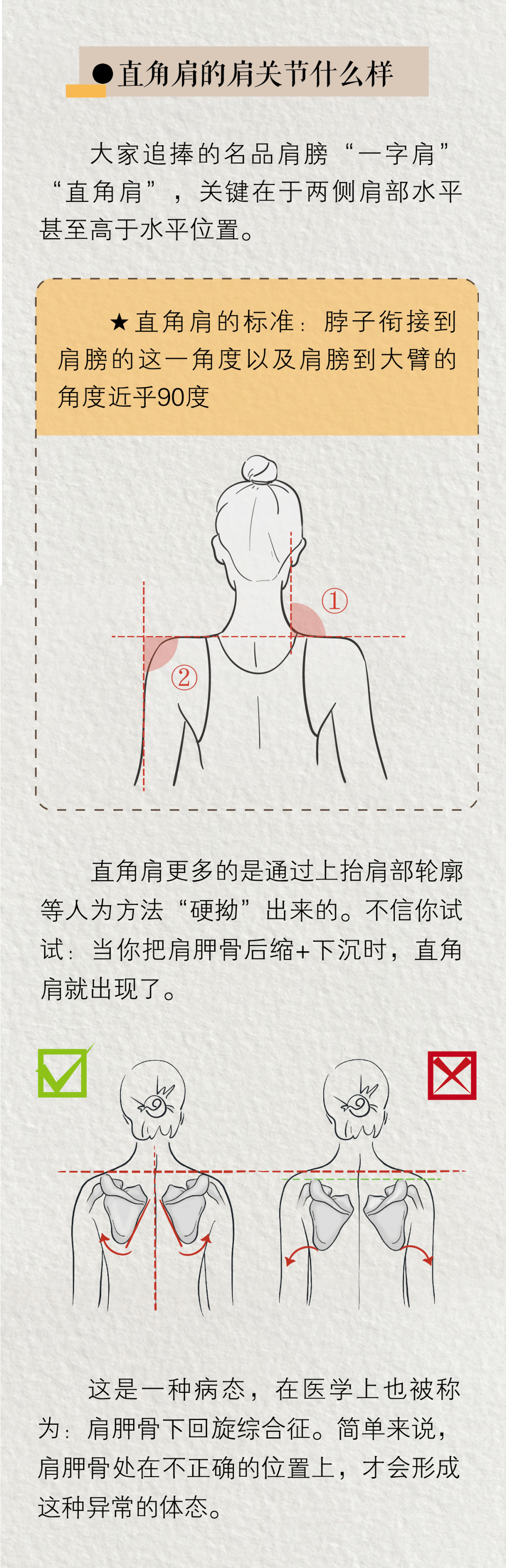 怎样判断是否是直角肩图片